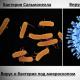 How to tell bacteria from viruses